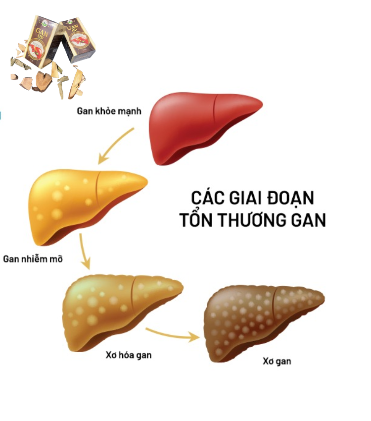 cac-giai-doan-ton-thương-gan