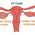cham-kinh