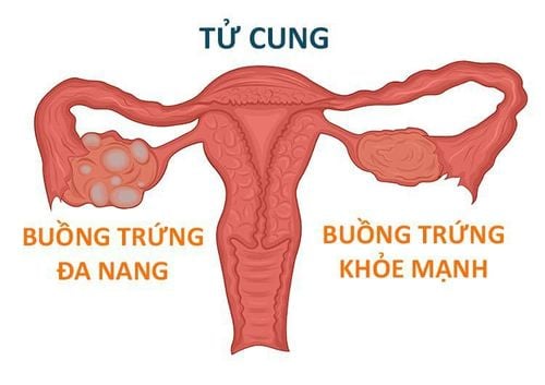 cham-kinh